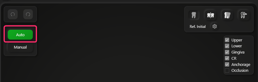 Auto button